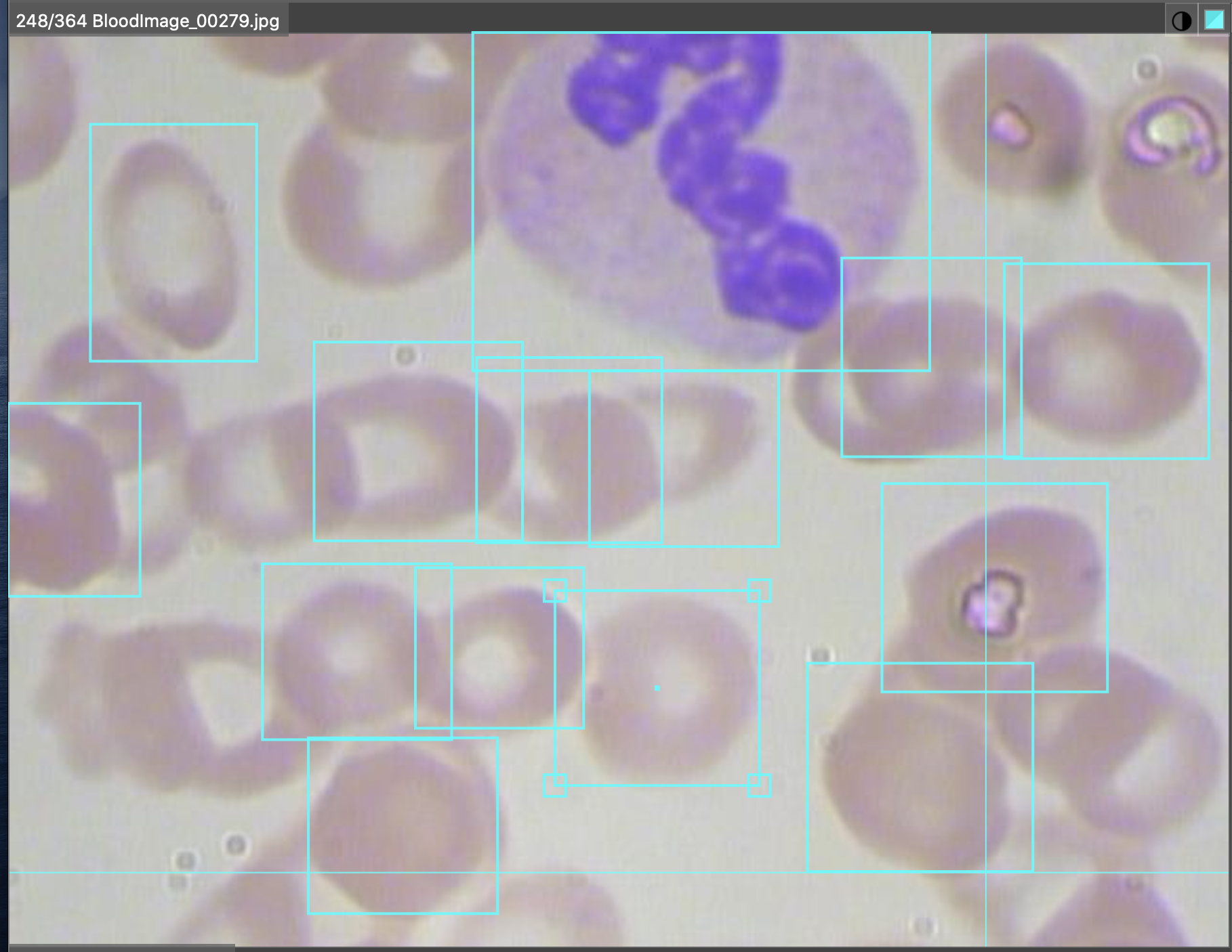 Microscope slide showing annotated blood cells.
