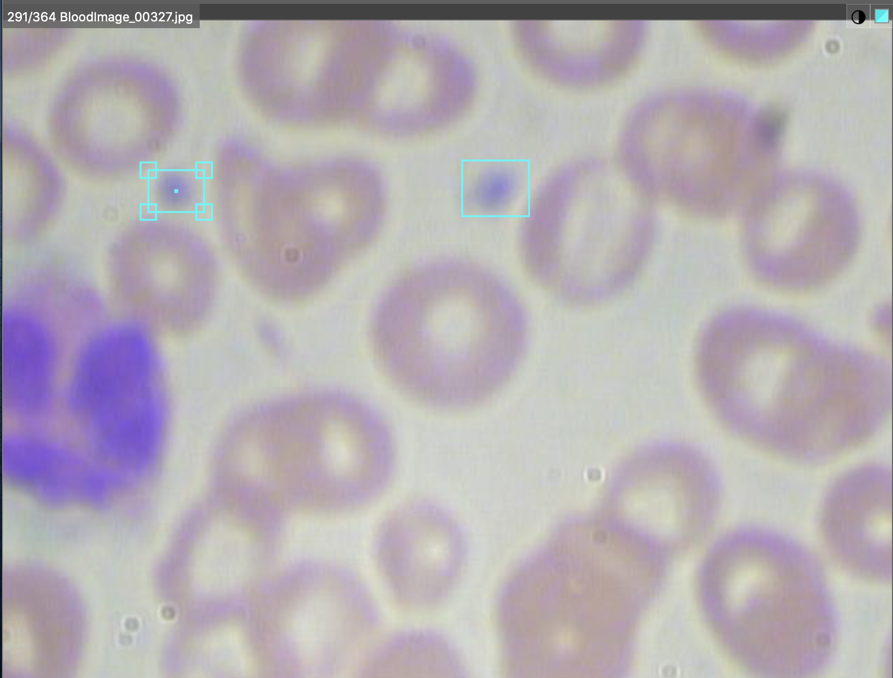 Microscope slide showing annotated platelets.