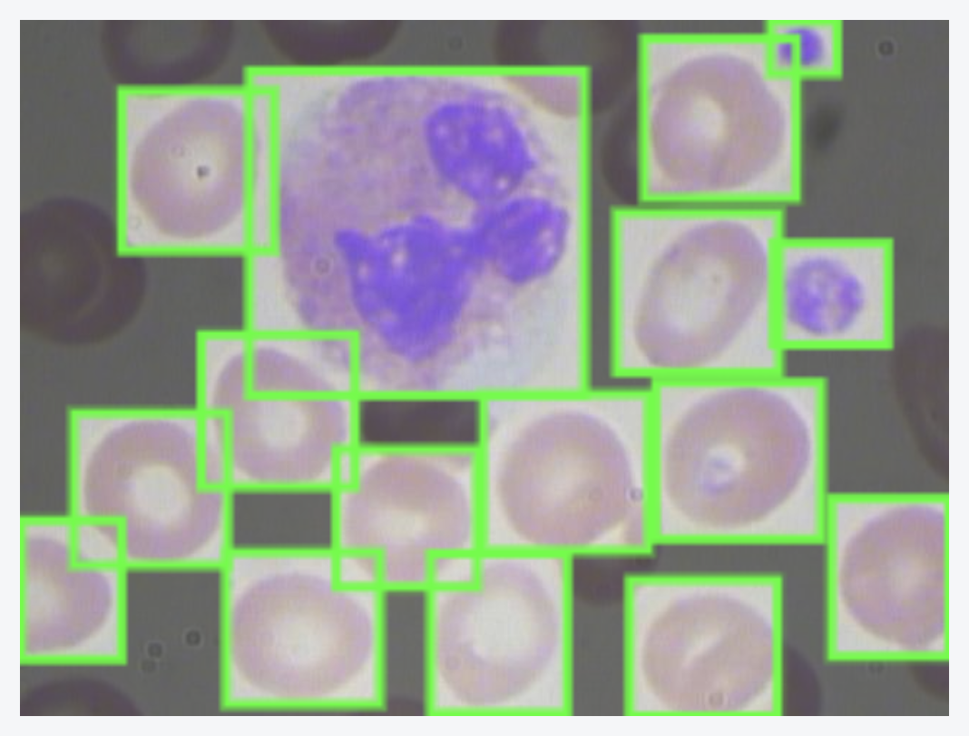 A microscope slide from the Blood Cell Count and Detection (BCCD) dataset