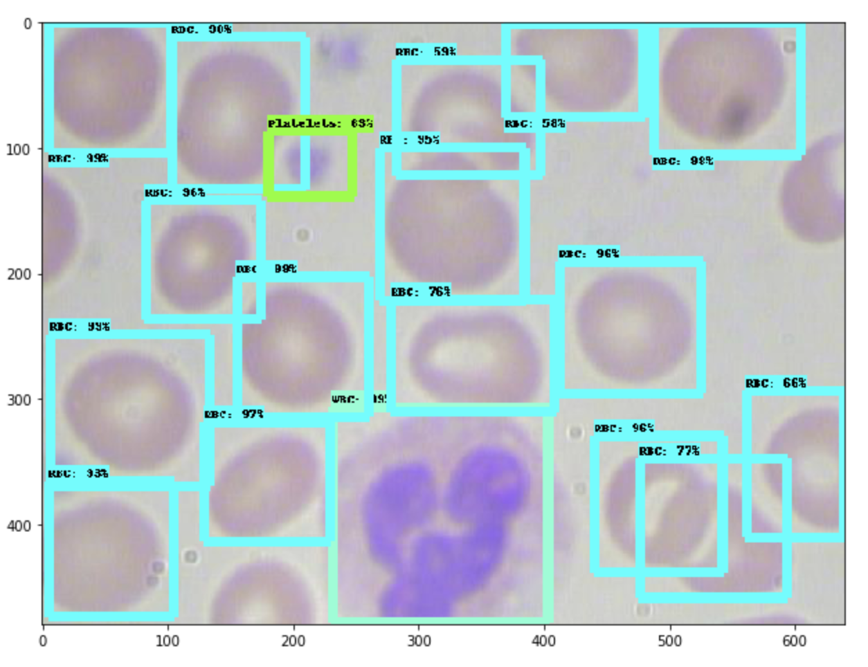 Model output screenshot showing detected blood cells and platelets in the BCCD dataset.