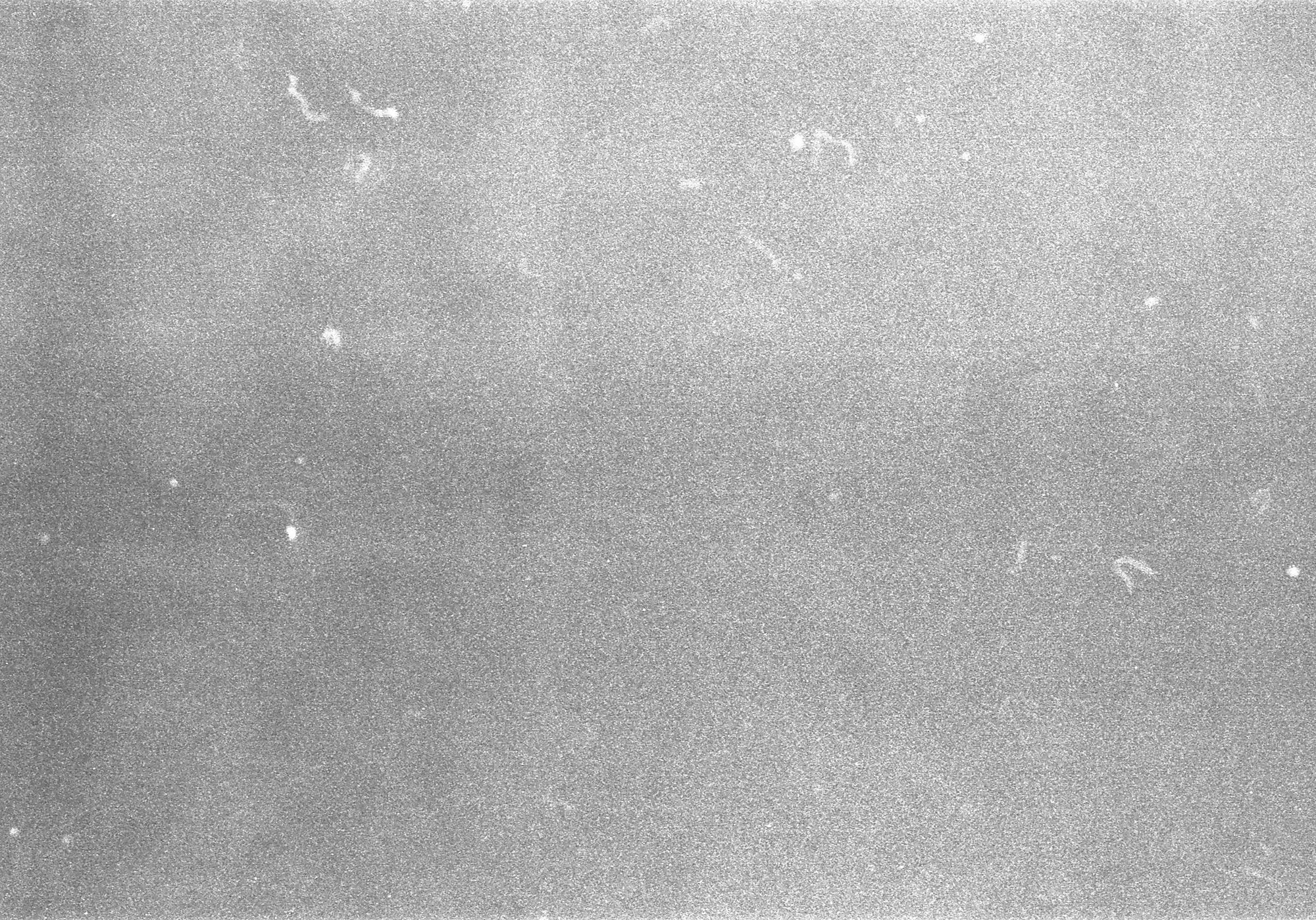 Example of noise on an image from an old fashioned film frame.