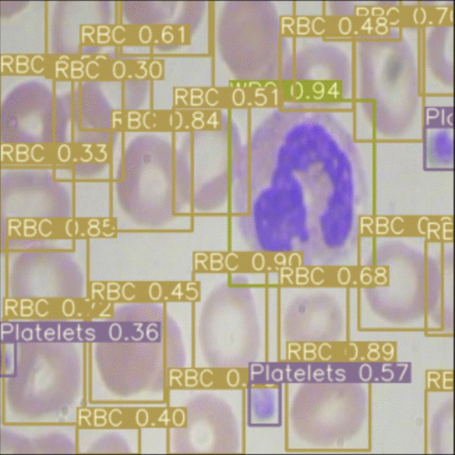 Inference on BCCD dataset showing red blood cells, white blood cells, and platelets outlined with colored boxes.