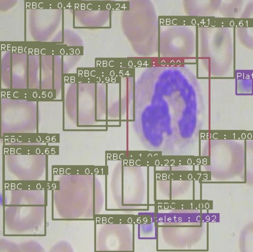 Inference screenshot detecting blood cells and platelets in the BCCD dataset.