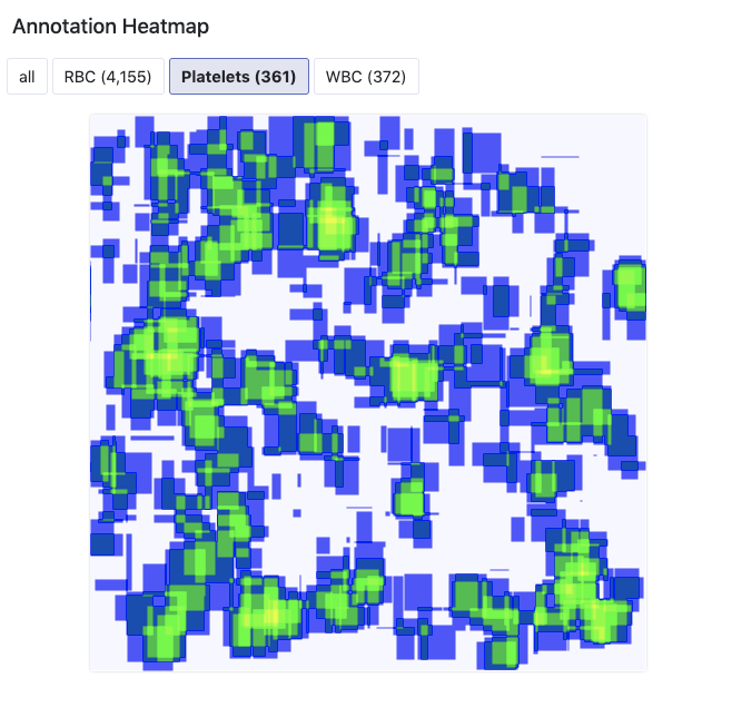 Roboflow Screenshot: Annotation Heatmap of Platelets (361 examples)