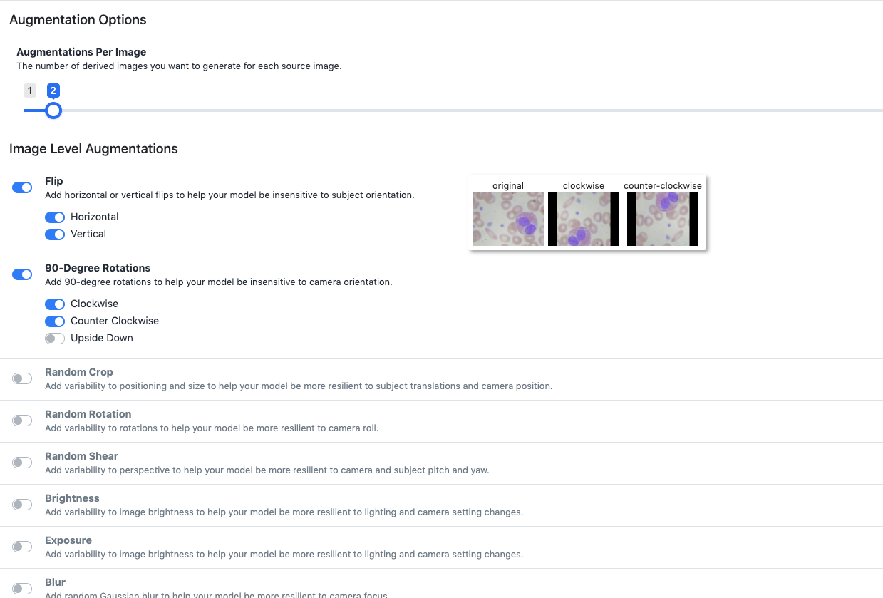 Roboflow Screenshot: Augmentation Options (Augmentations Per Image, Flip, 90-Degree Rotations, Random Crop, Random Rotation, Random Shear, Brightness, Exposure, Blur)