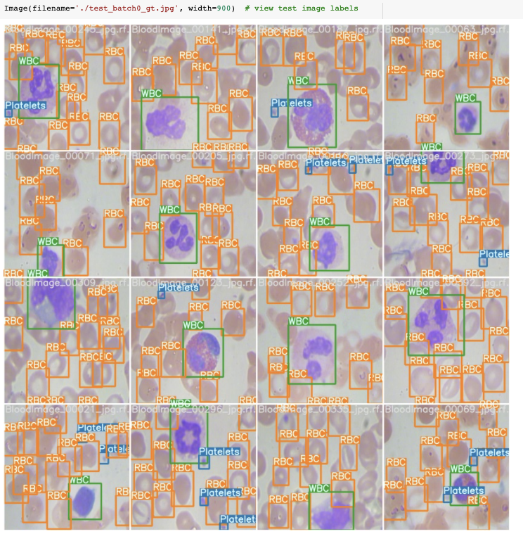 BCCD Dataset Image Visualization (showing Red Blood Cells, White Blood Cells, and Platelets)