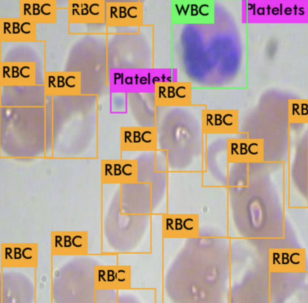 An annotated image of red/white blood cells, and platelets from the BCCD dataset.