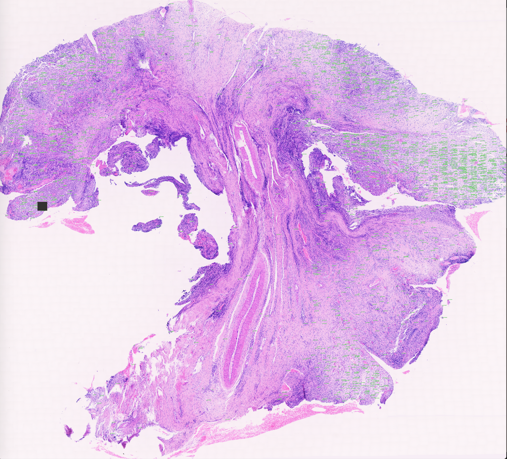 A cell population with neutrophils labeled.