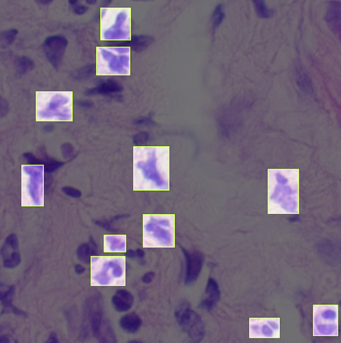 Neutrophils labeled for object detection with bounding boxes.