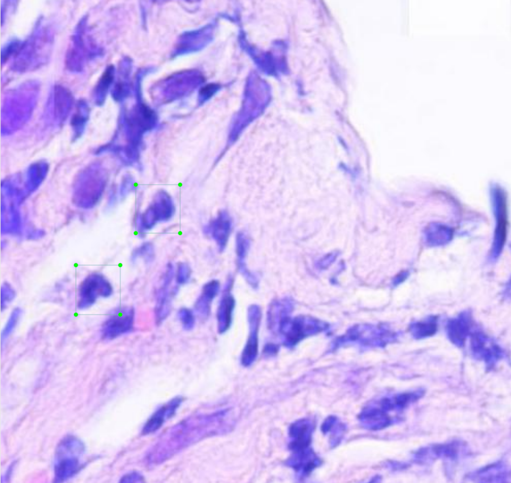 Neutrophils labeled for computer vision object detection.