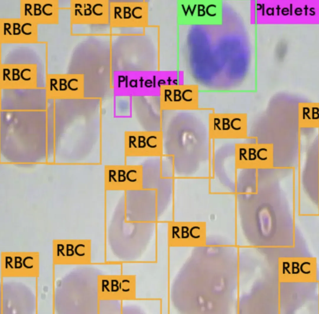 An annotated image of red/white blood cells, and platelets from the BCCD dataset.