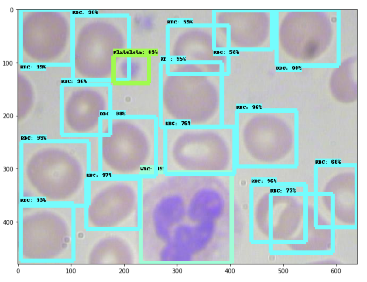 Training a TensorFlow MobileNet Object Detection Model with a Custom Dataset