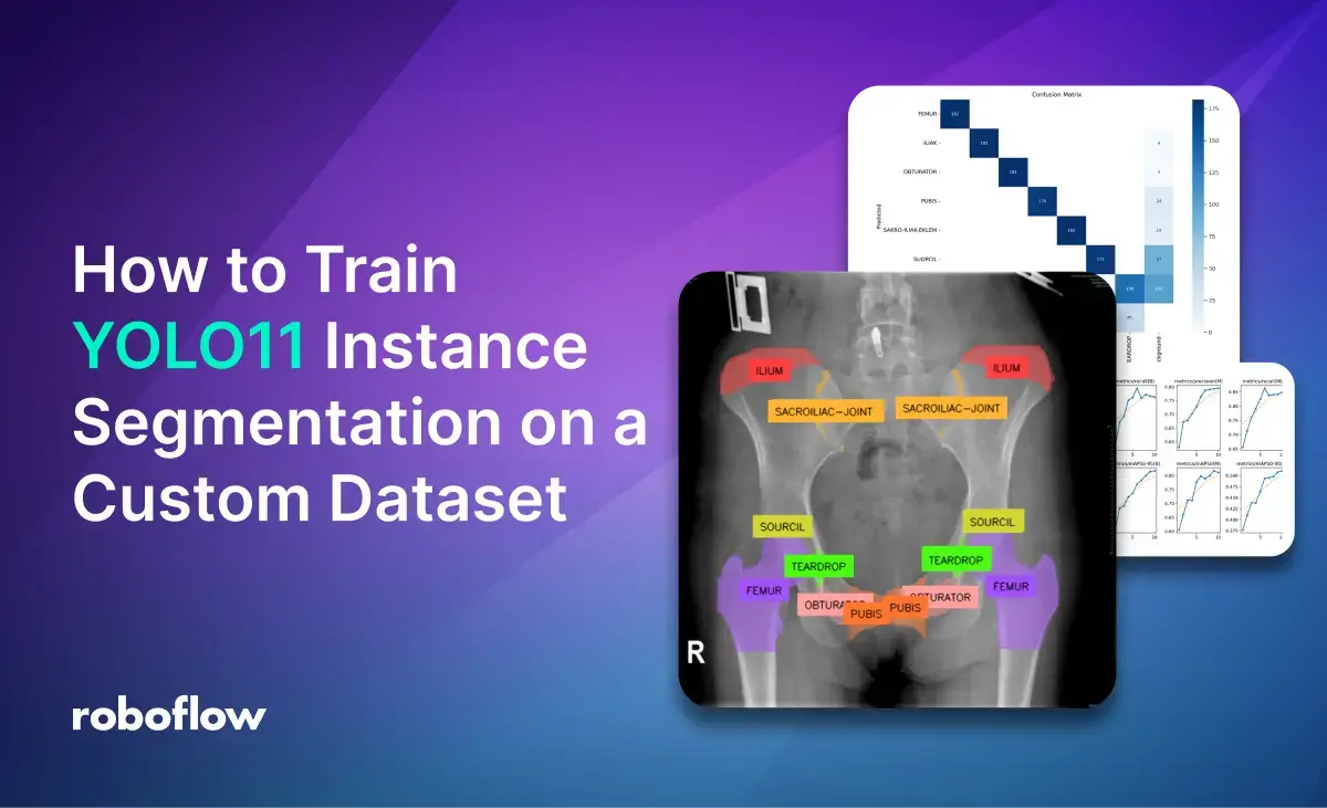 How to Train YOLOv11 Instance Segmentation on a Custom Dataset