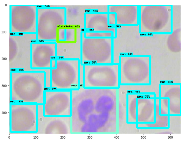 Training a TensorFlow MobileNet Object Detection Model with a Custom Dataset